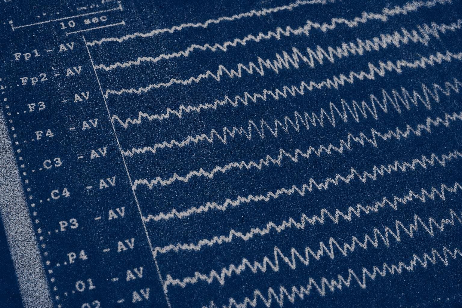 Hero image for "The Ganzfeld's Statistical Anomaly Is Real. What It Proves Is Still the Question."