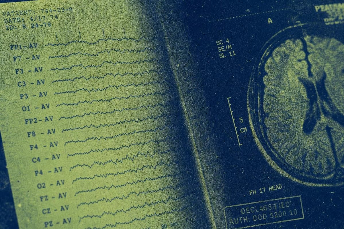 Hero image for "The Brain Scans Are Real. The Signal Is Still Ambiguous."