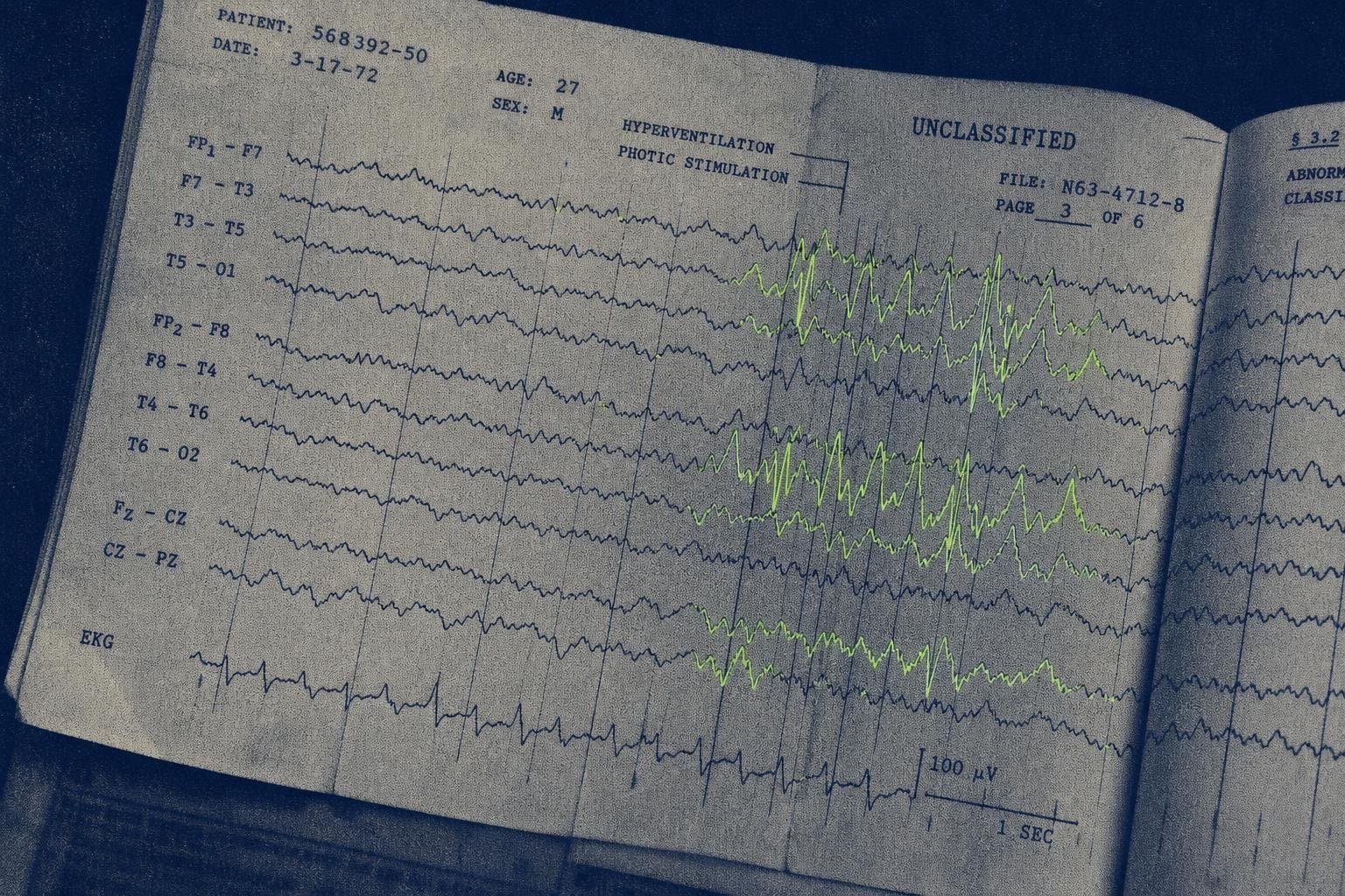 Hero image for "Terminal Lucidity Isn't Rare — It's Just Never Been Counted Properly"